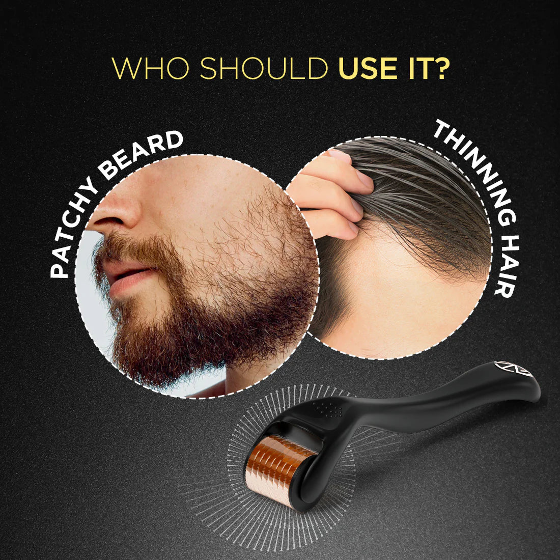 Customize Derma Roller1.5mm for Hair & Beard Growth Microneedling Roller Beard Face Body Scalp Derma Roller for Men Women