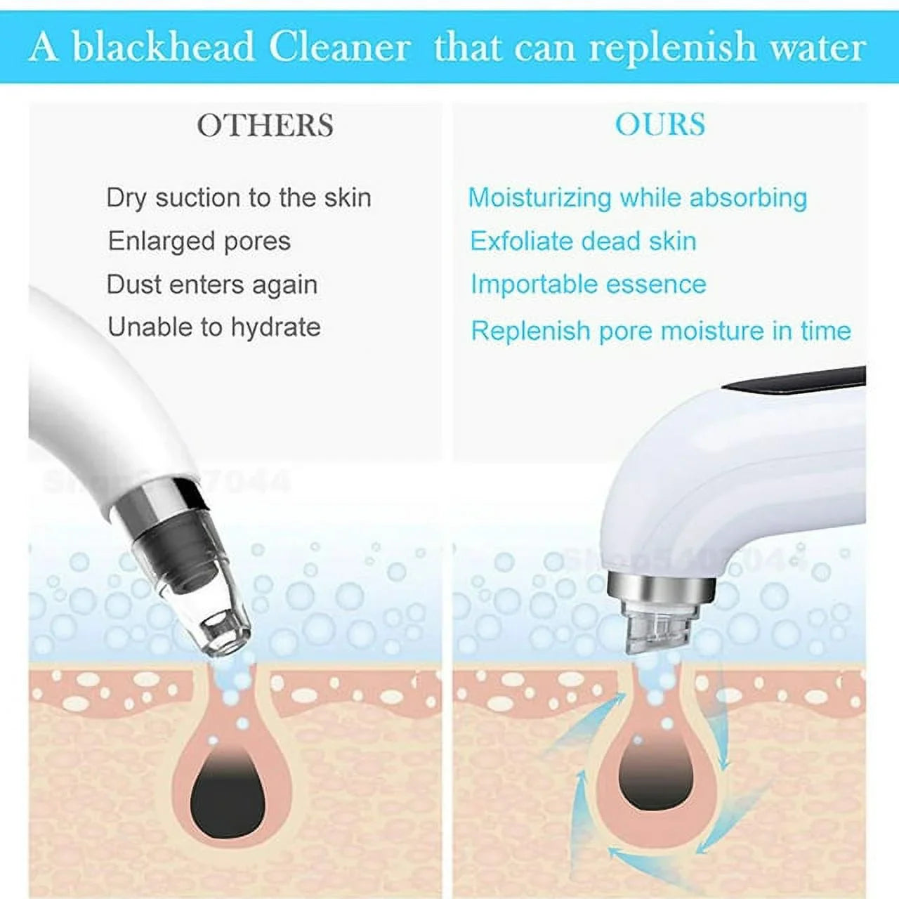 2 in 1 Pore Vacuum Skin Moisturizing Wrinkles Blackhead Remover Hair Care Dermoelectroporation Hydralift EP HydraDEP Machine