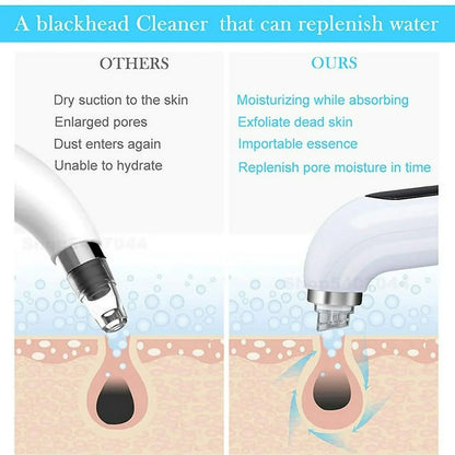 2 in 1 Pore Vacuum Skin Moisturizing Wrinkles Blackhead Remover Hair Care Dermoelectroporation Hydralift EP HydraDEP Machine
